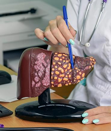 Cirrhotic Liver.